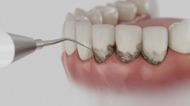 Trusted Teeth Cleaning And Checkup service in Cross Roads, TX - Dentist Open Now